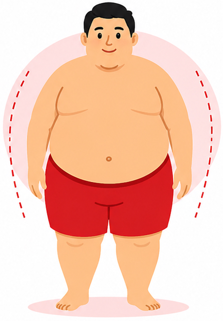 Obesitas